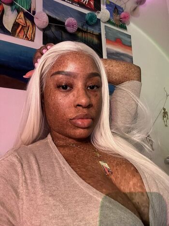 freckledn