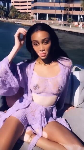 Winnie Harlow
