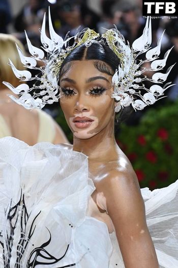 Winnie Harlow